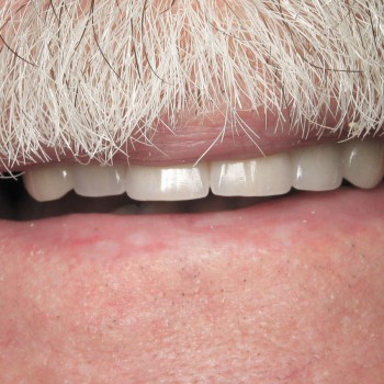 dentists in Thornton